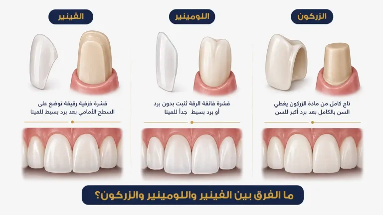 الفرق بين الفينير واللومينير والزيركون في تجميل الأسنان