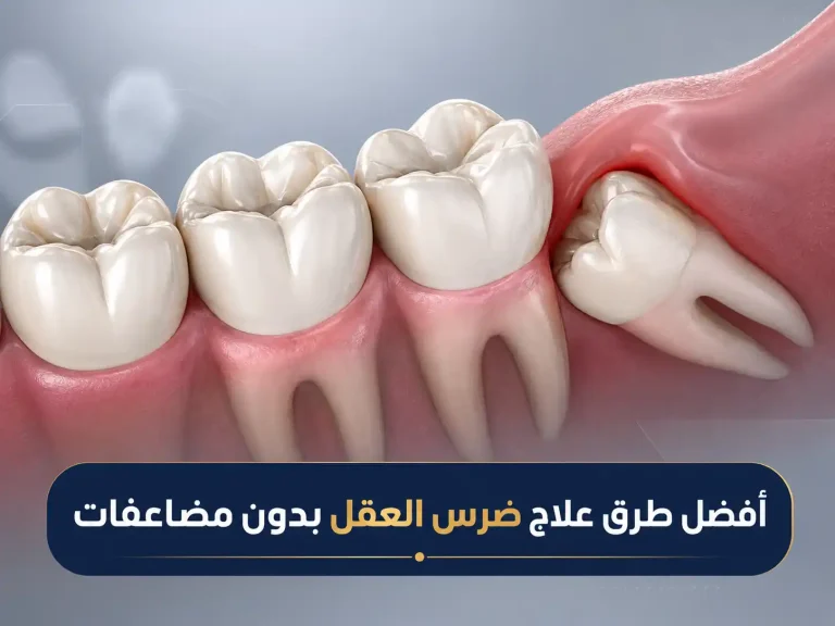 علاج وجراحة ضرس العقل بدون ألم